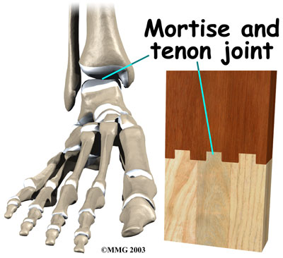 Mortise and Tenon