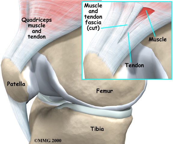 Tendons of the Knee