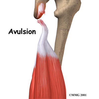 knee hamstring anatomy